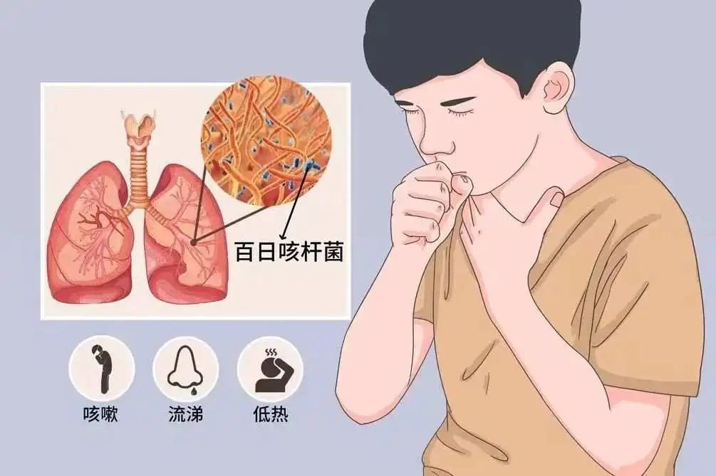 百日咳.jpg
