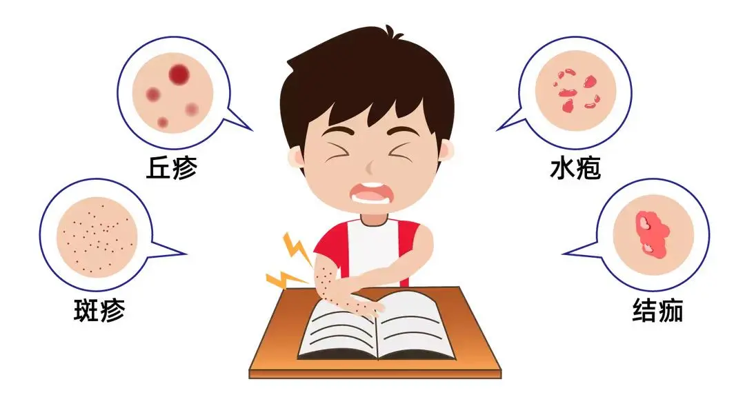 水痘.png 水痘.png